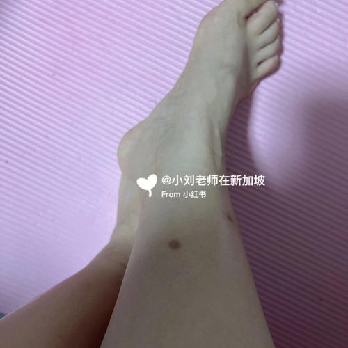 女人能长期涂鳄鱼油的效果